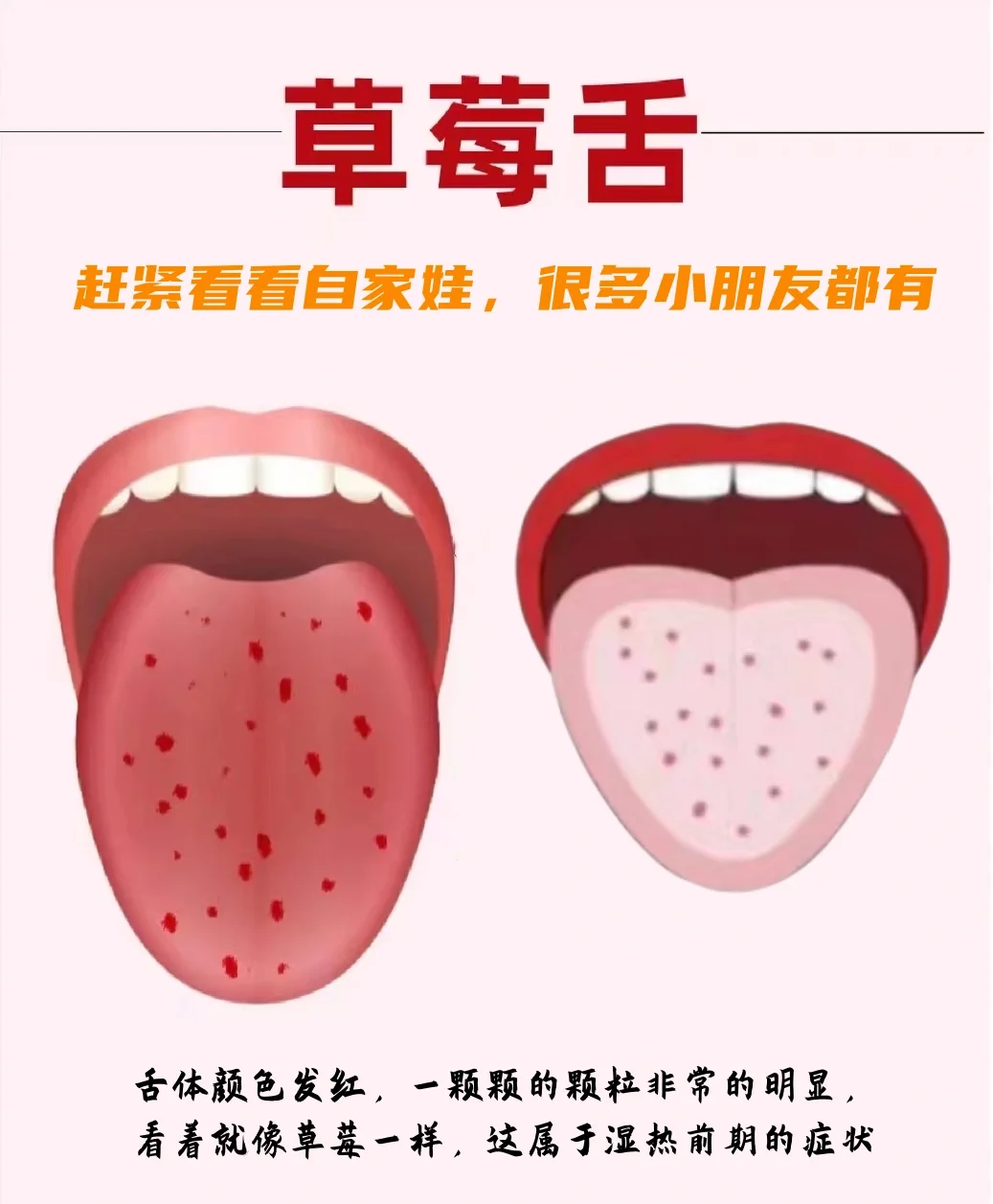 舌头上有红点点不痛不痒