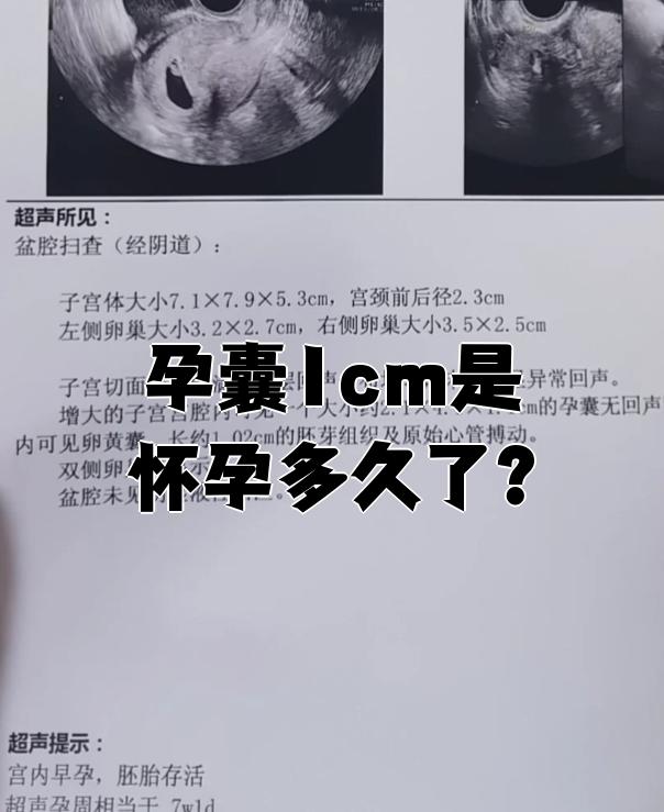 2026年1月4日 第22页
