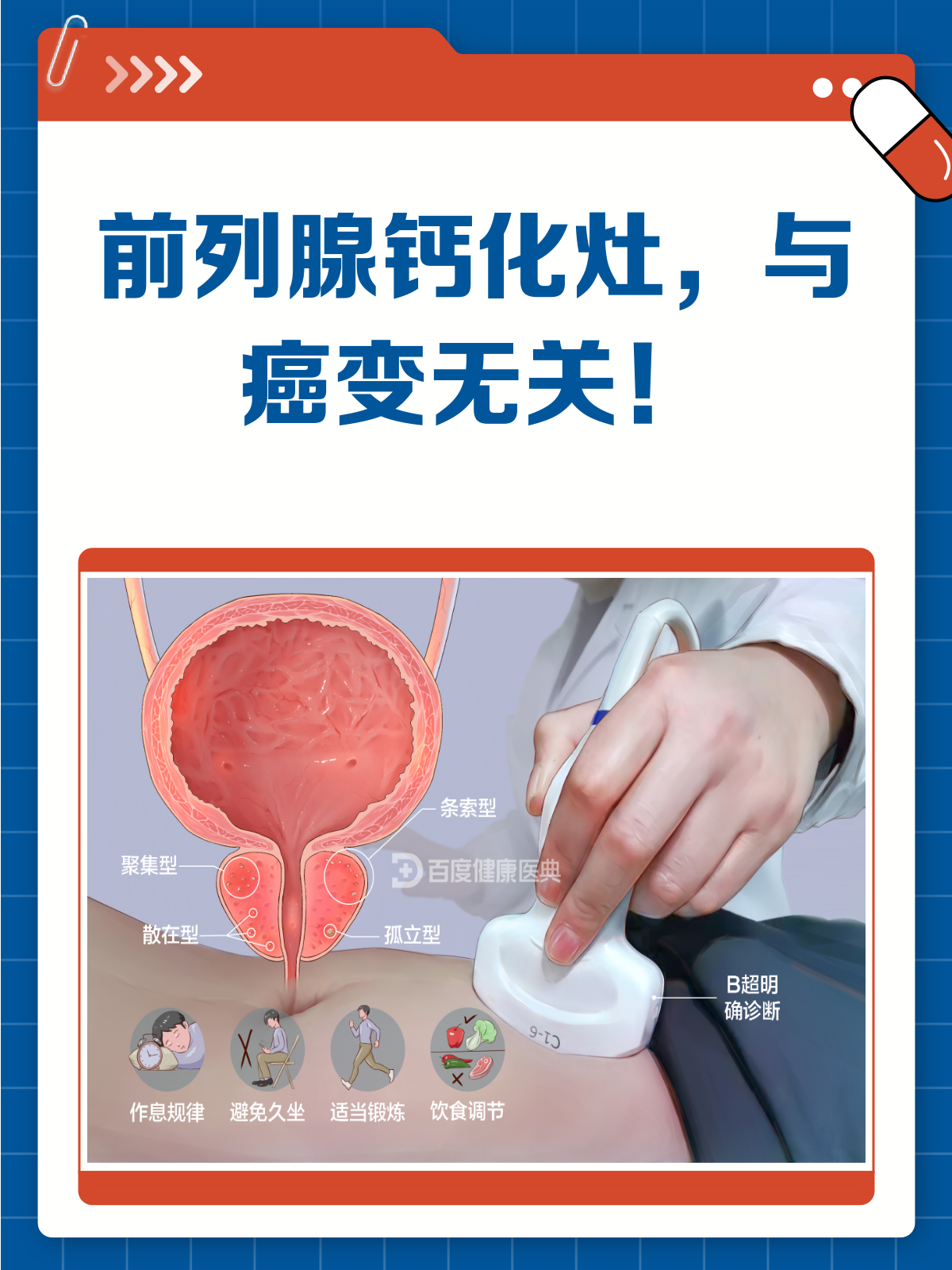 前列腺钙化增生严重吗