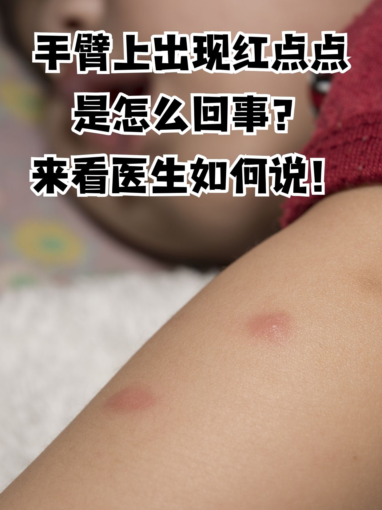 身上长红点是怎么回事?