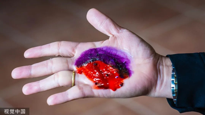 汞中毒用什么解毒