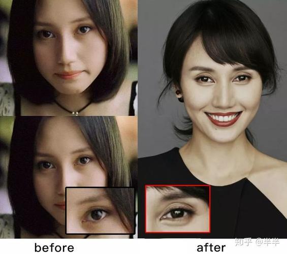 眉骨和眼睛和脸部严重不对称