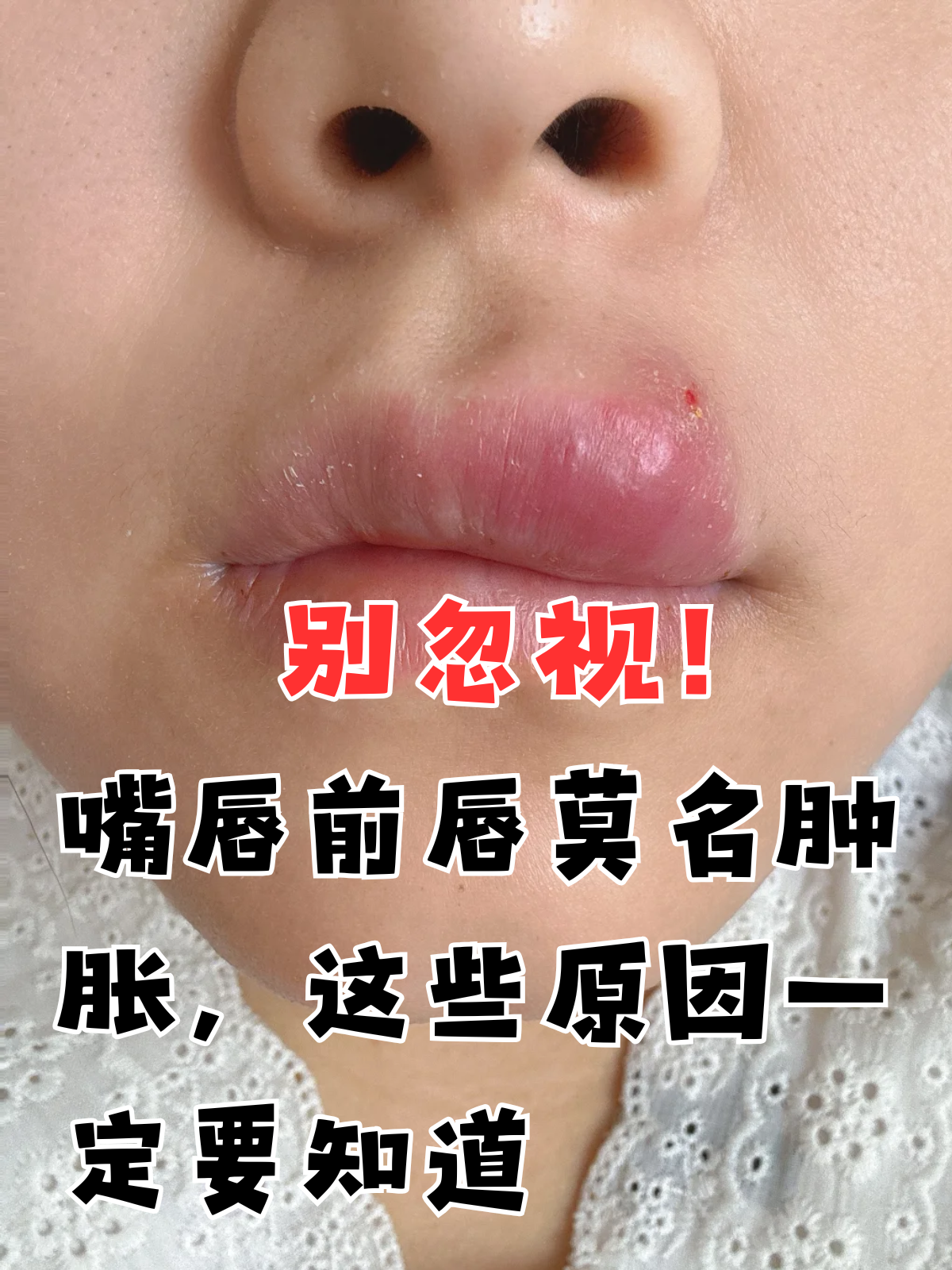 2026年1月4日 第14页