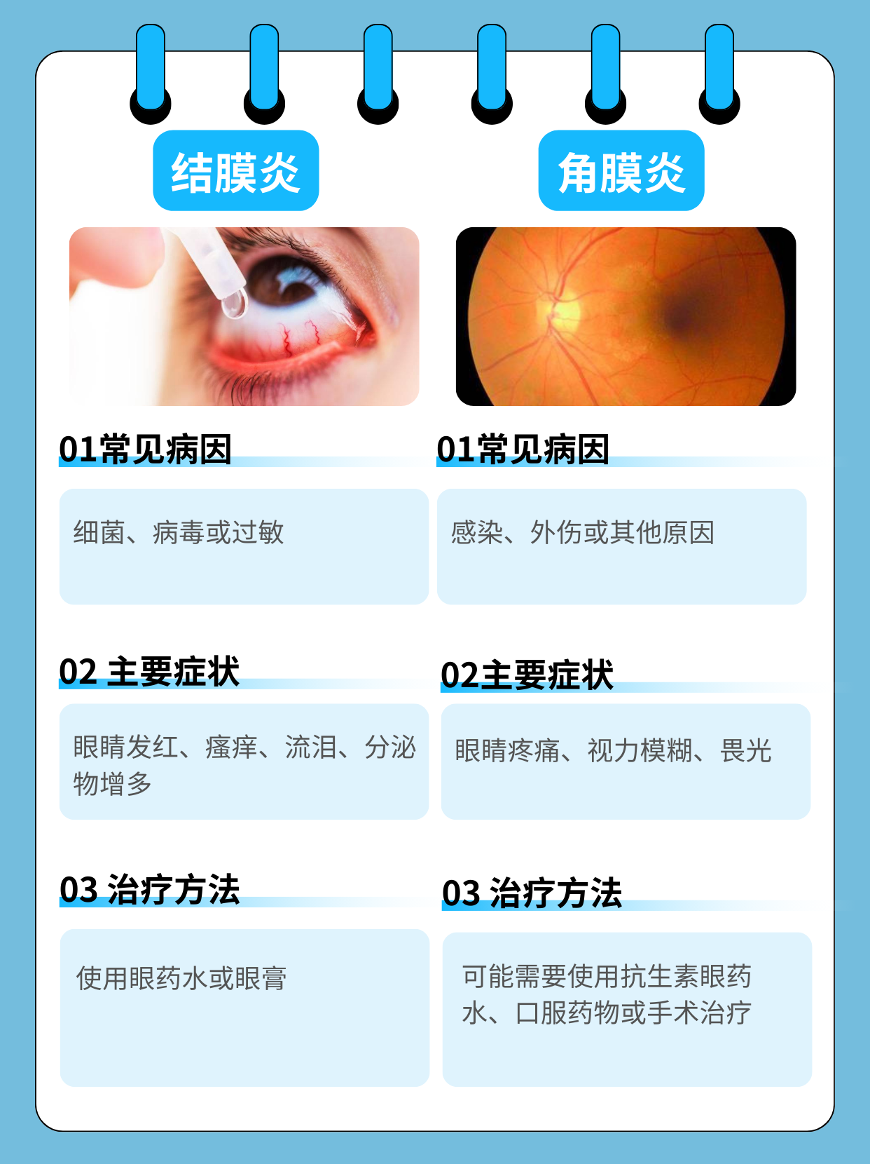 急性角膜炎多久治好吗