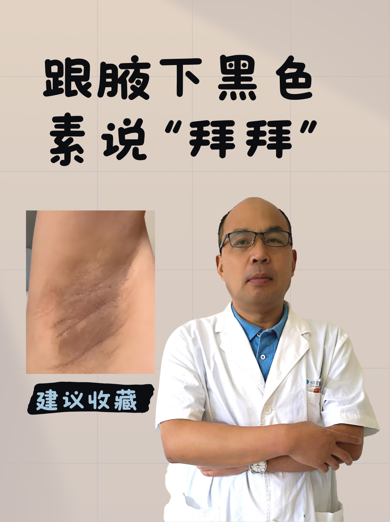 孕妇腋窝发黑怎么回事?