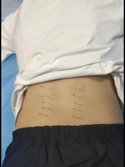 2026年1月4日 第4页