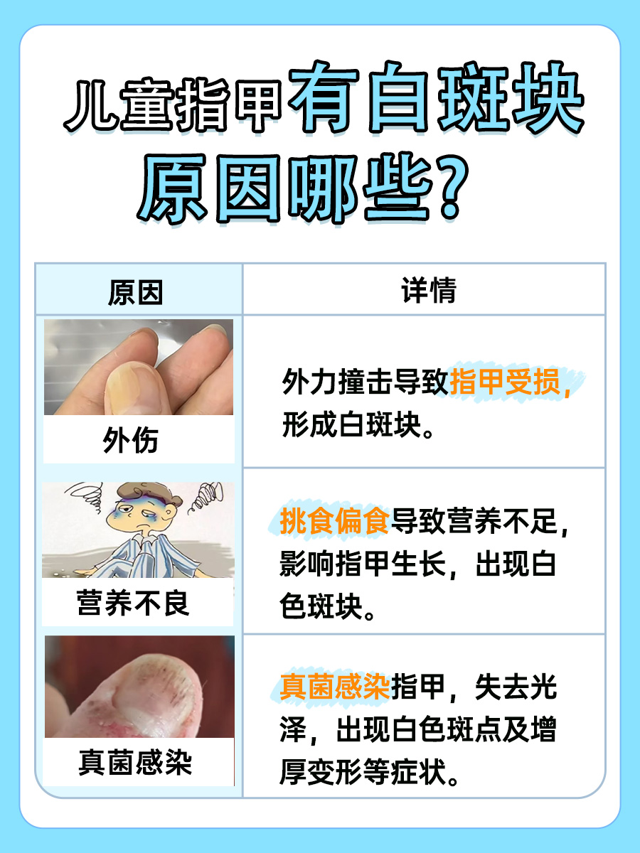 脚趾甲变白是什么原因?