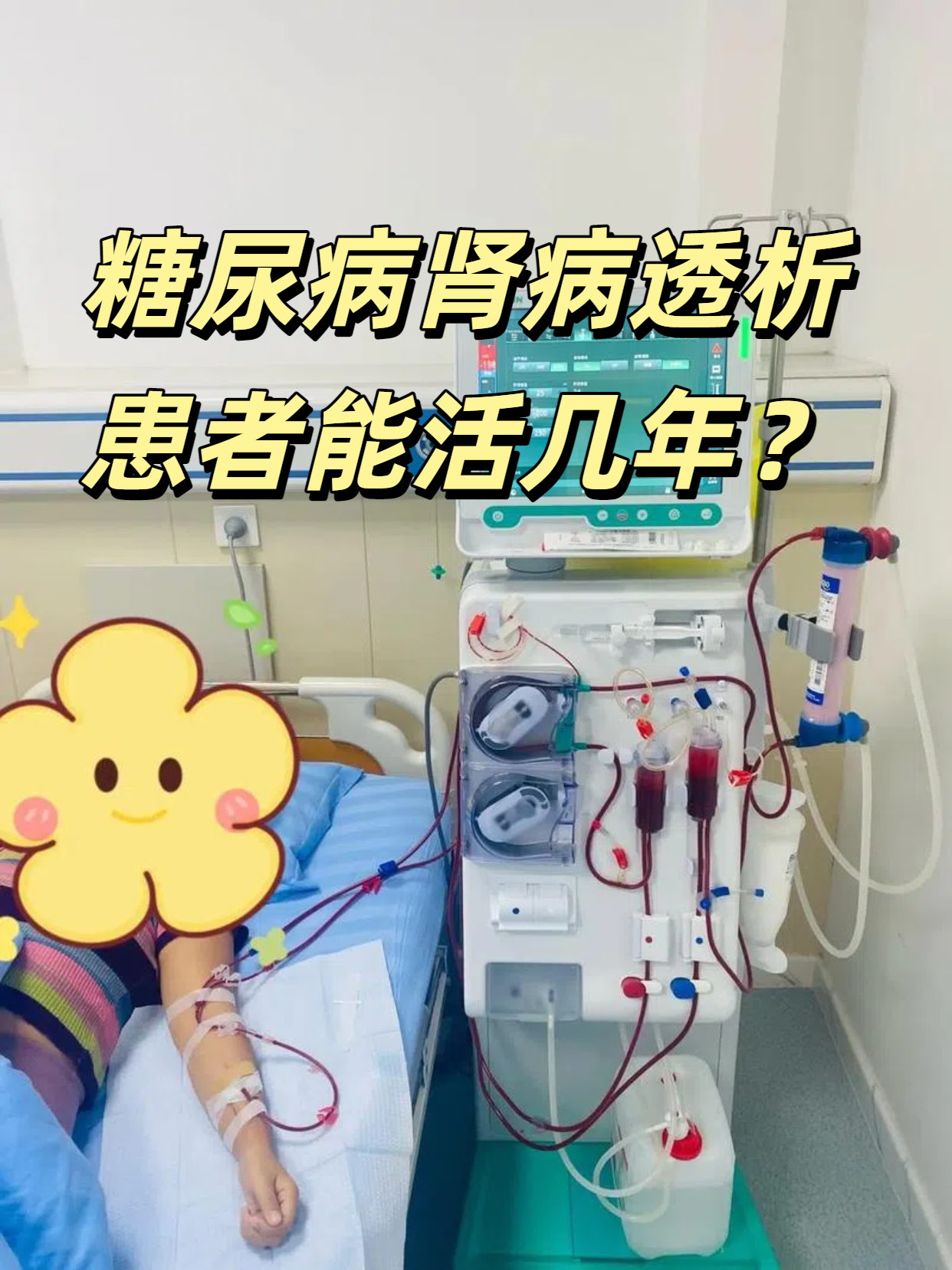 尿毒症透析能活几年