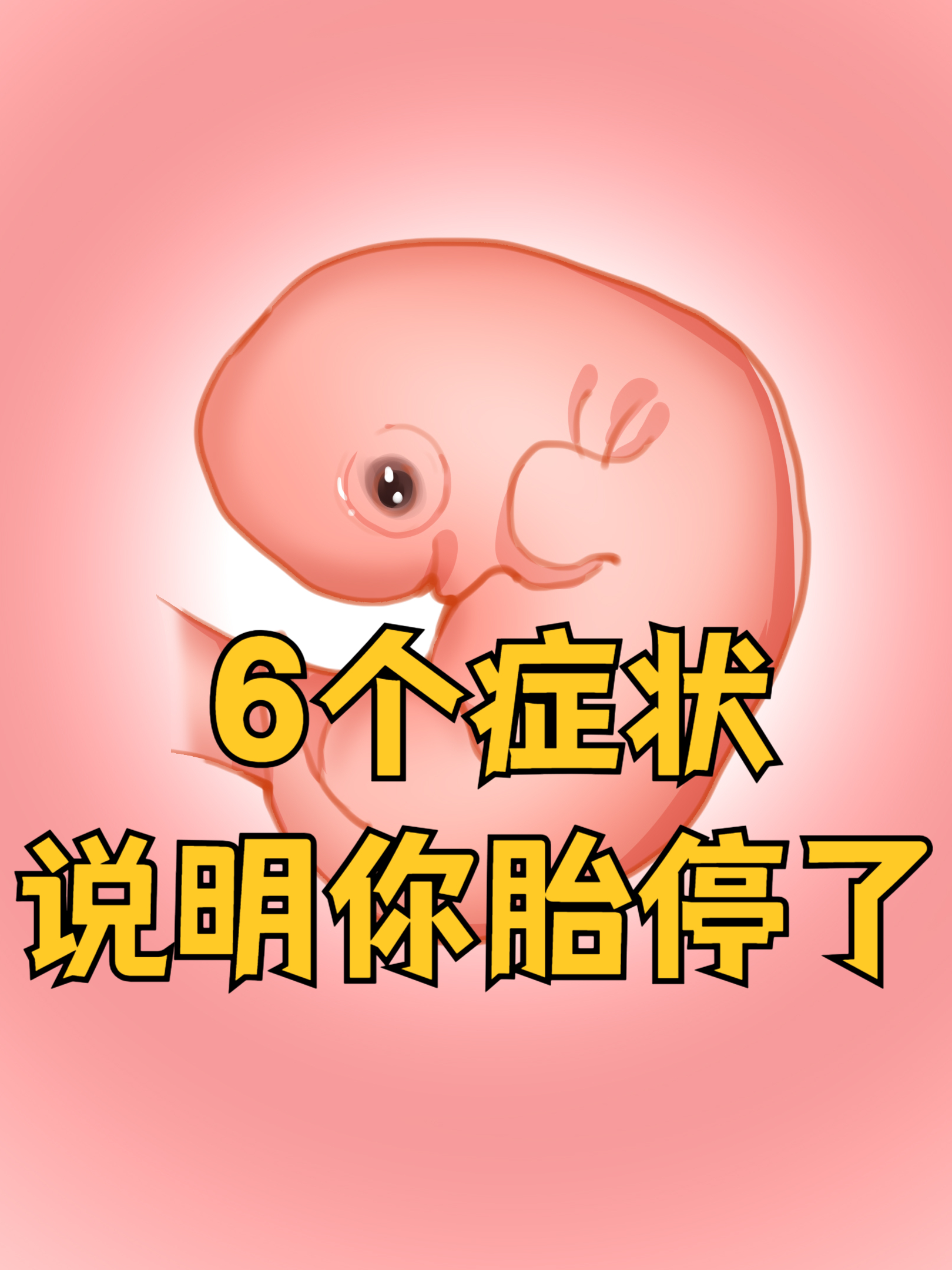 怀孕5个月胎停症状有哪些?