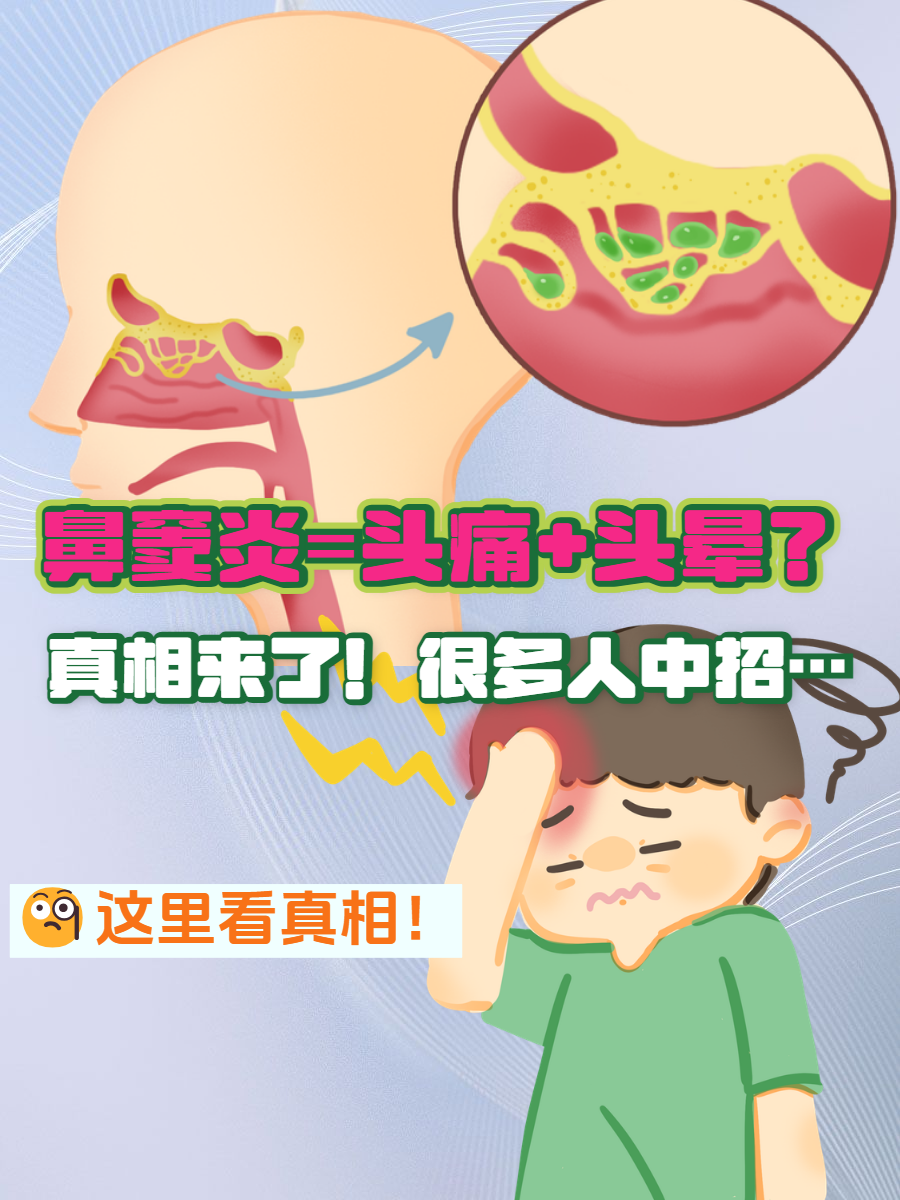 鼻窦炎能引起头疼吗