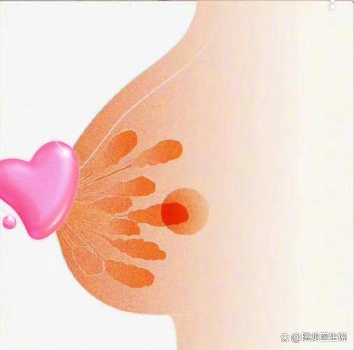 哺乳期乳房有硬块