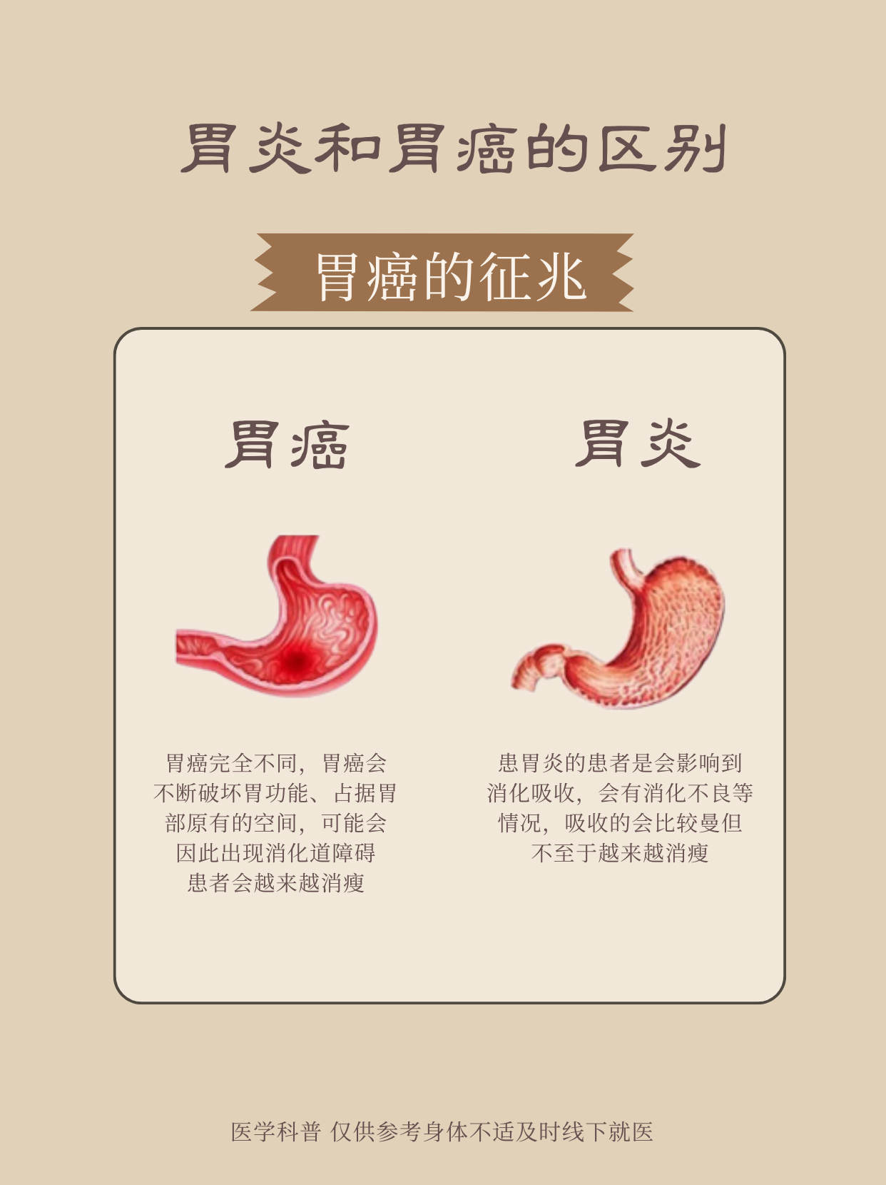 导致胃癌的主要原因有哪些?