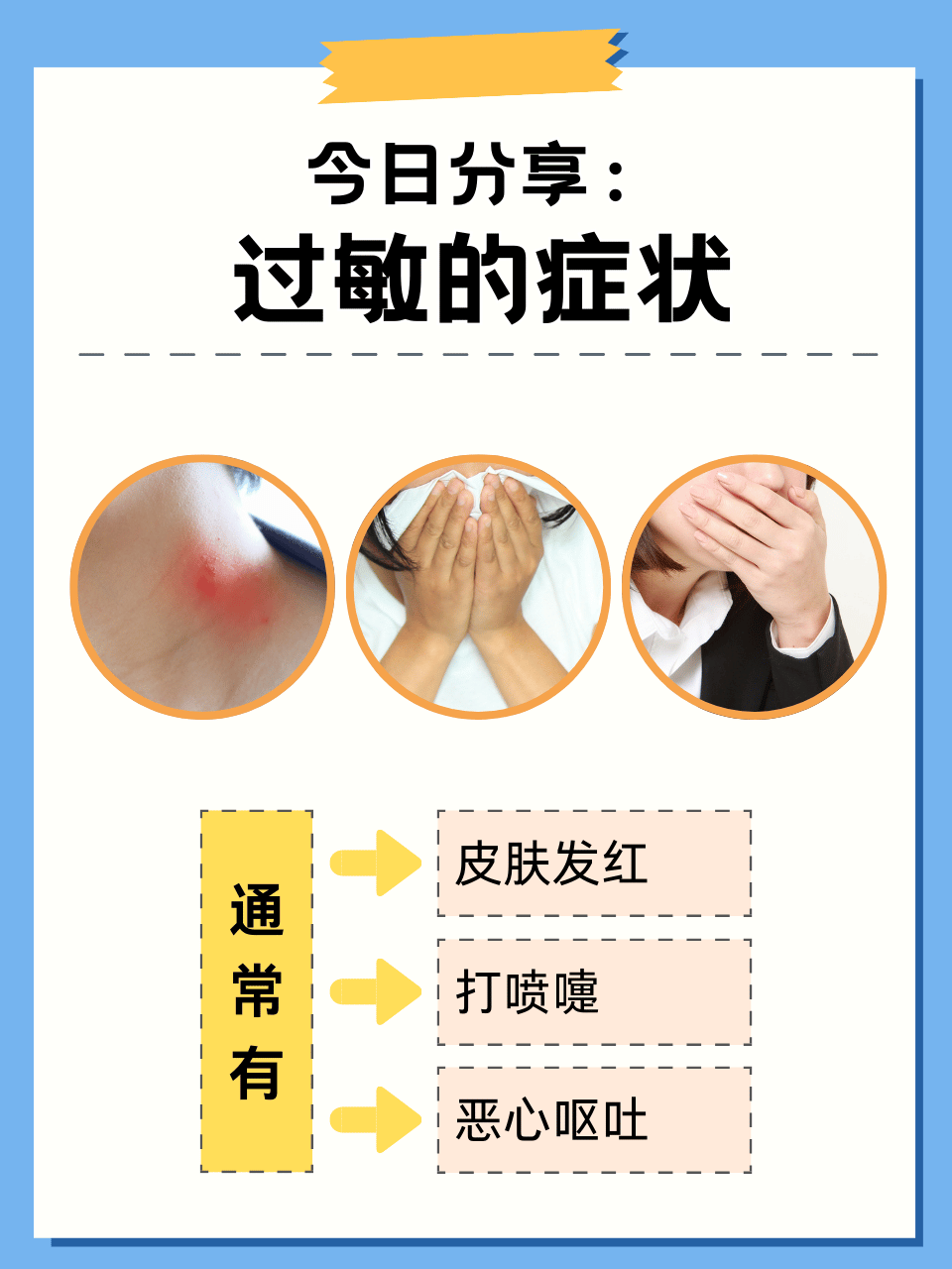 皮肤过敏很痒怎么办