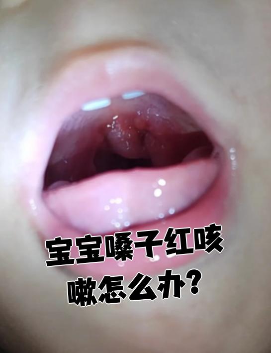 宝宝肺炎的早期症状有哪些