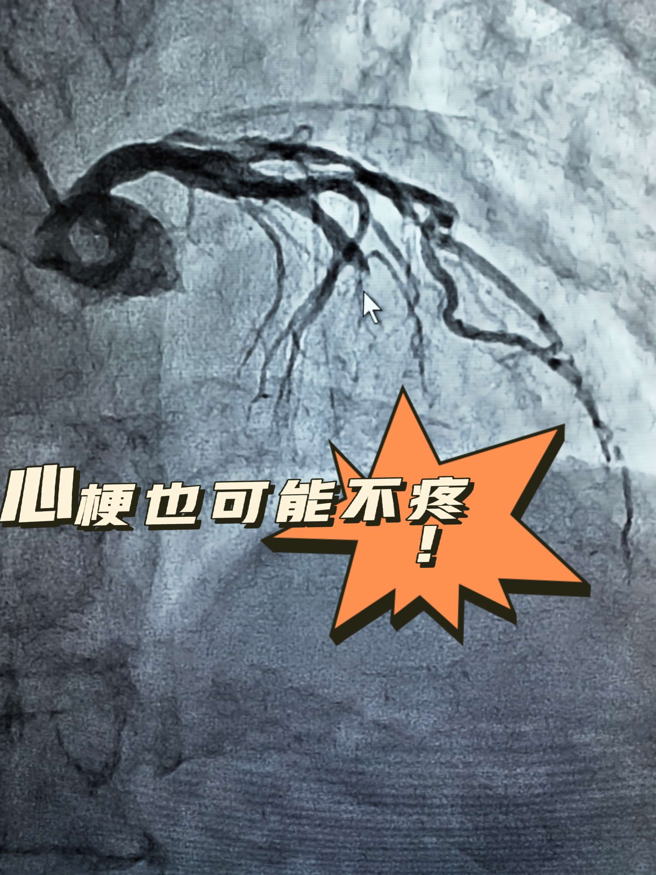 心包积液能活多久..