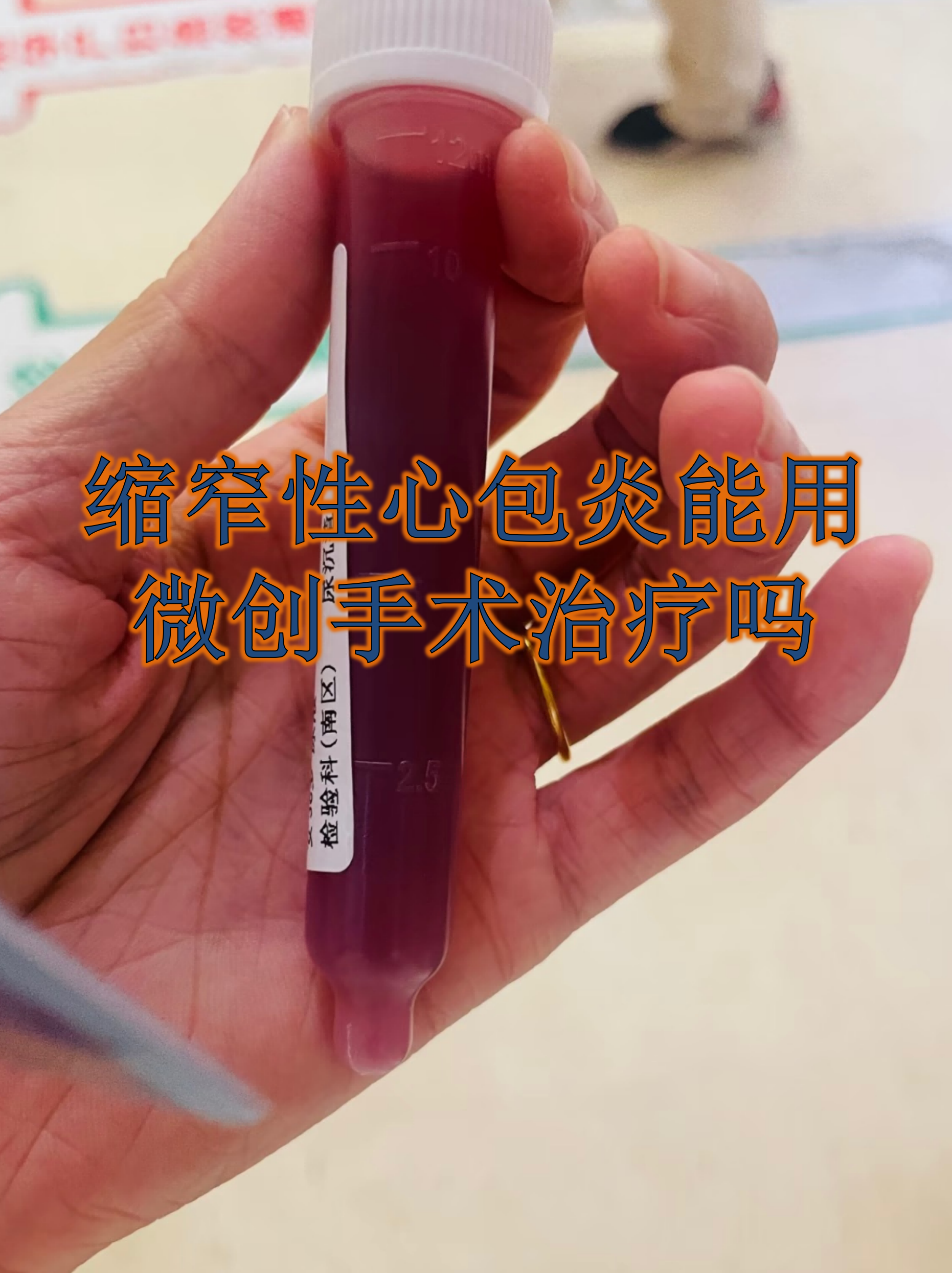 心包积液能活多久..