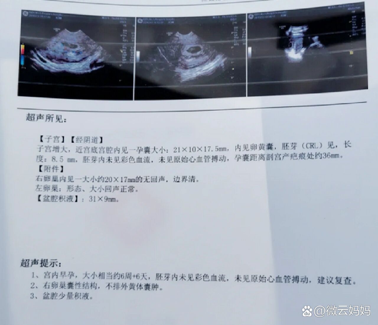 2026年1月5日 第33页