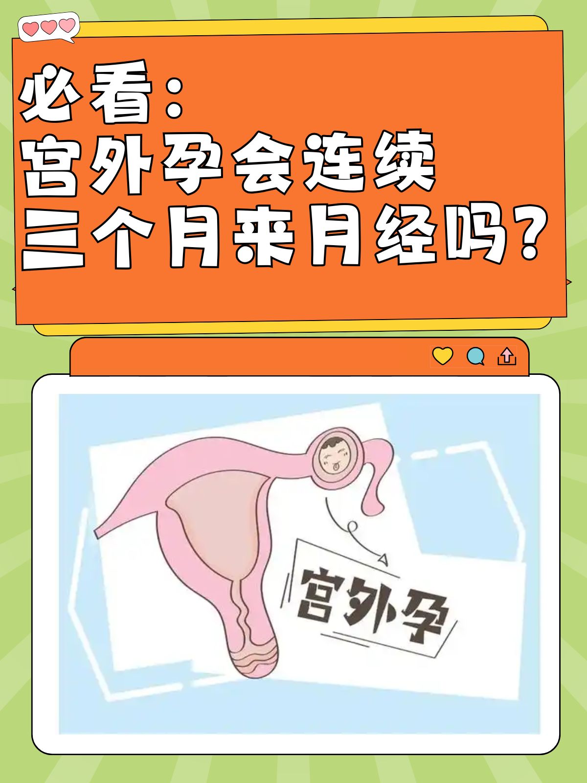 宫外孕有什么前兆