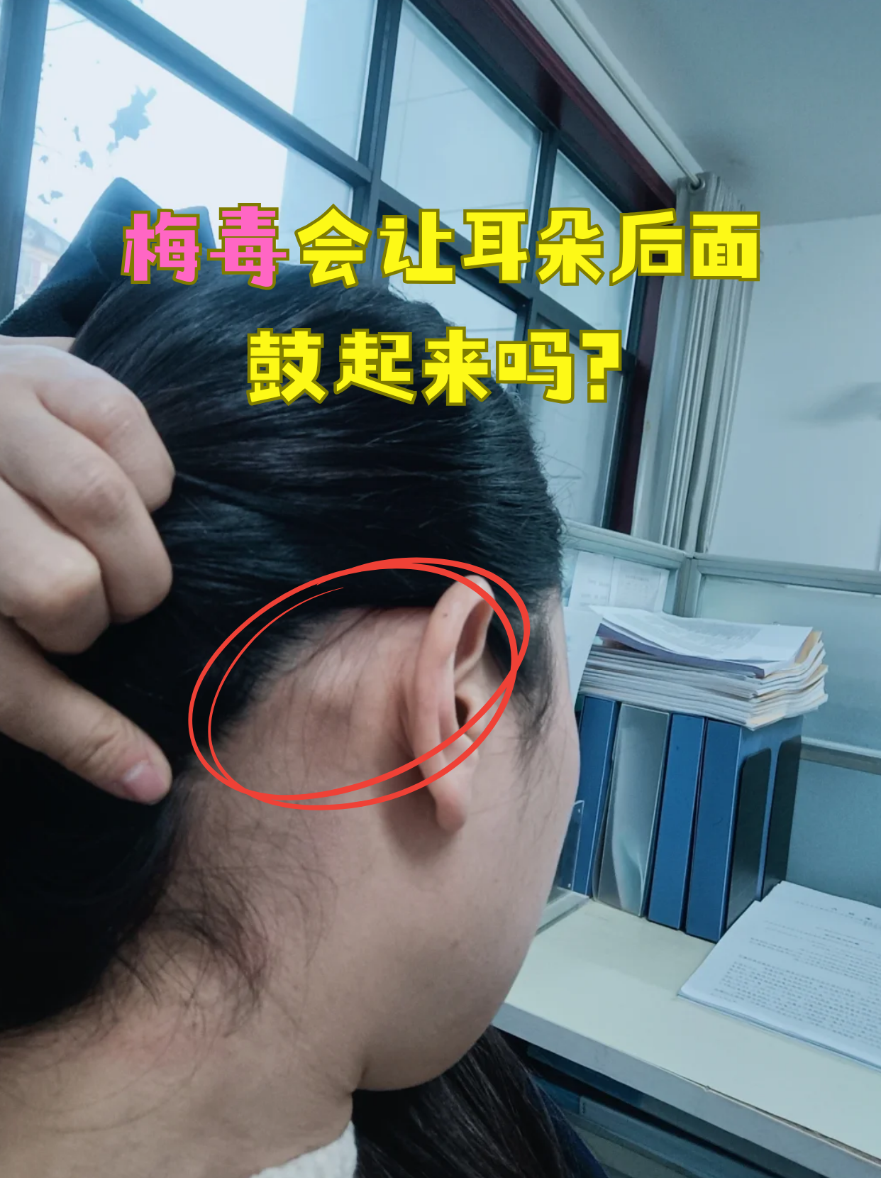 耳朵后面长个硬包.按还疼
