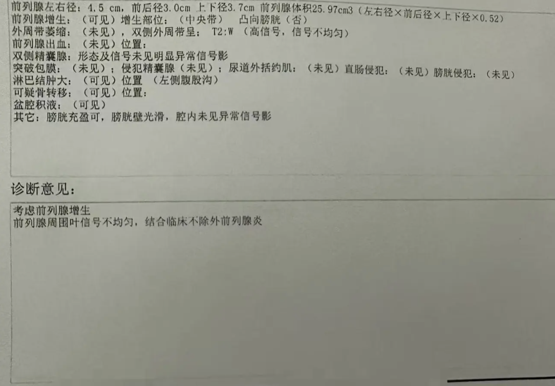 帕罗西汀能治疗早泄吗?