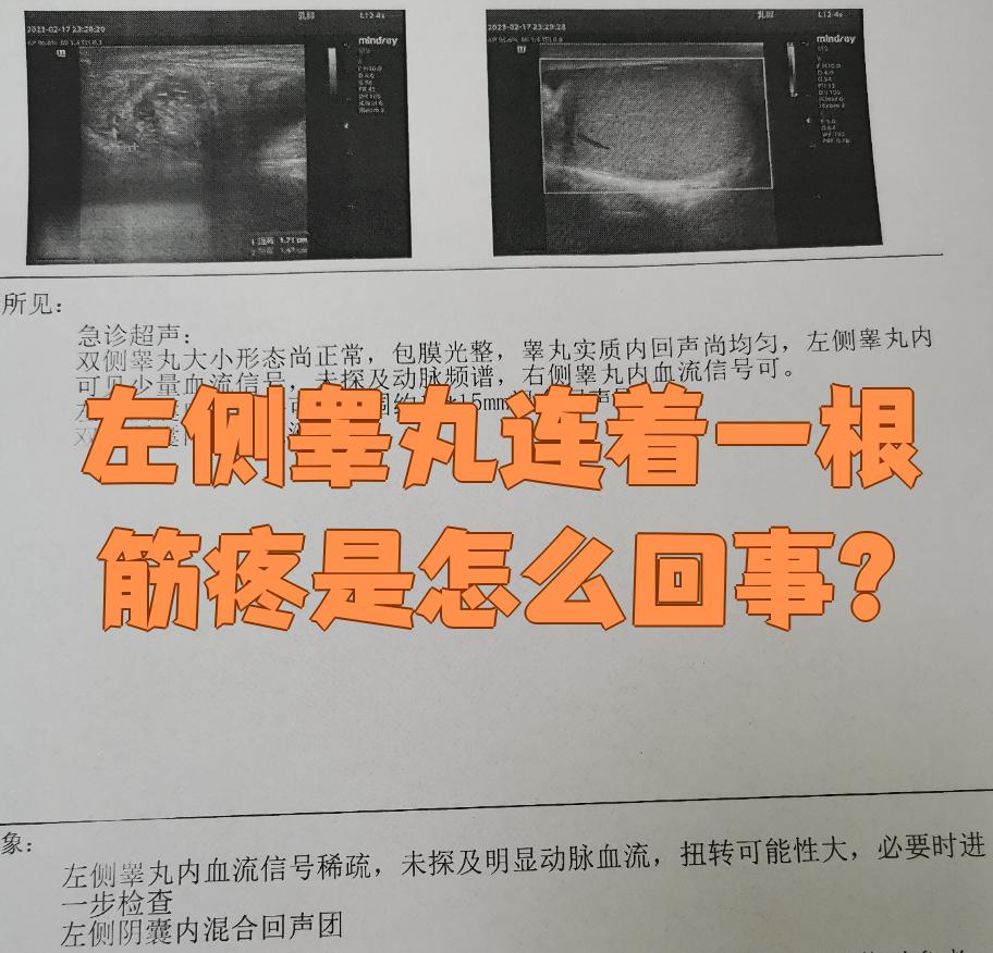左睾丸疼是怎么回事?