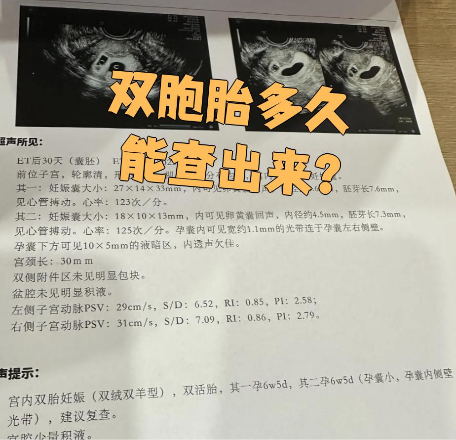 打过胎会检查出来吗