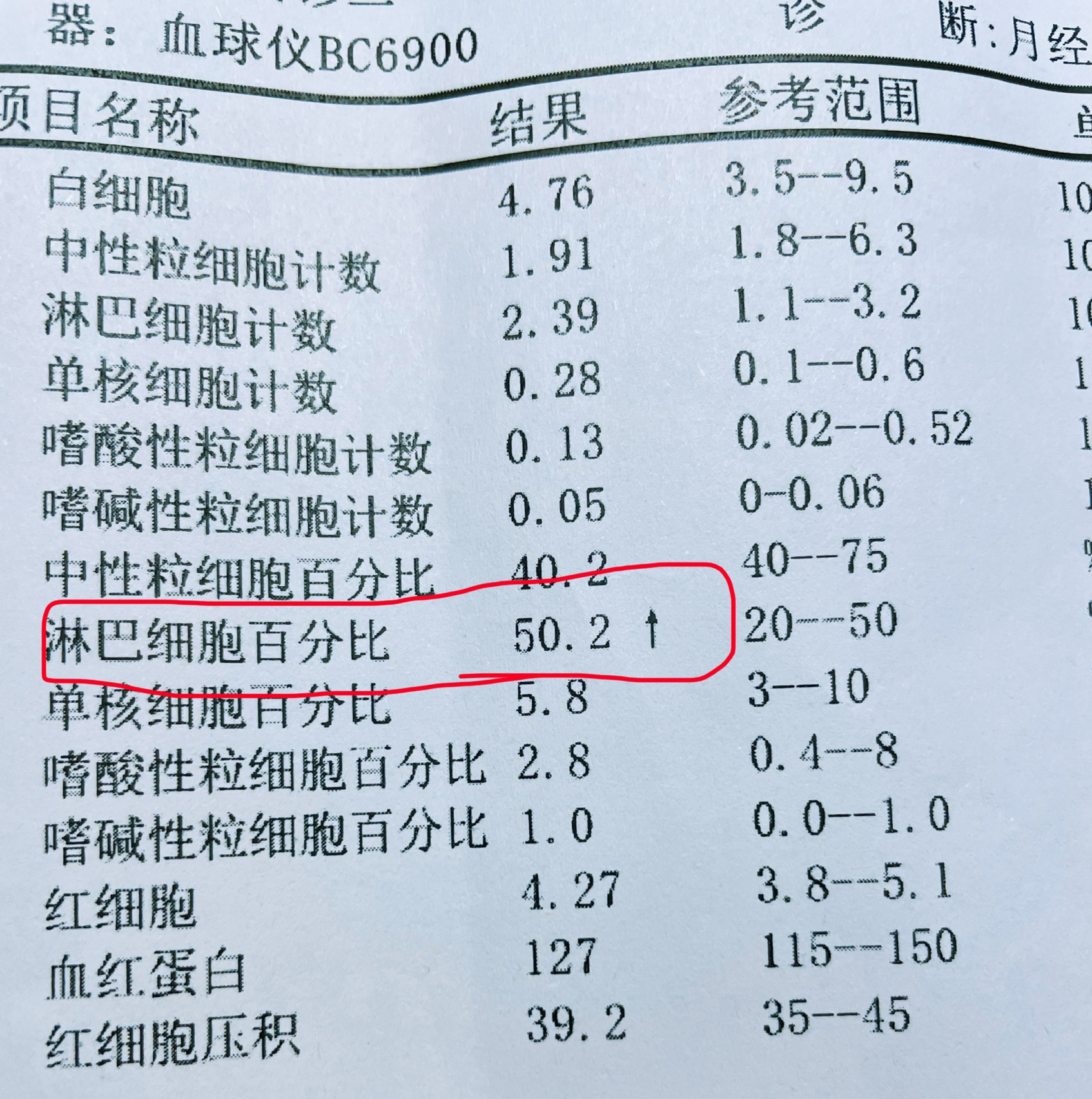 垂体泌乳素正常值是多少