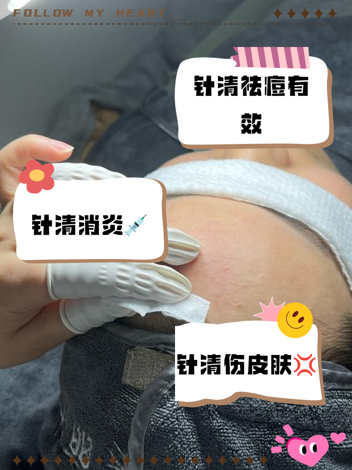 退烧针有没有副作用的