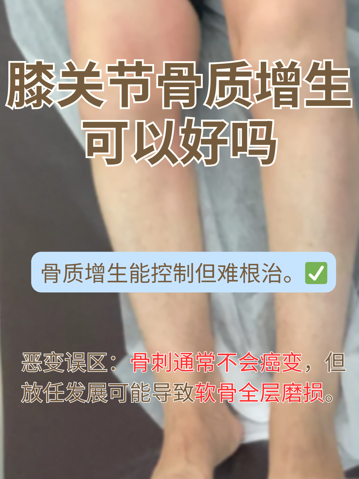 膝盖骨质增生怎么除根