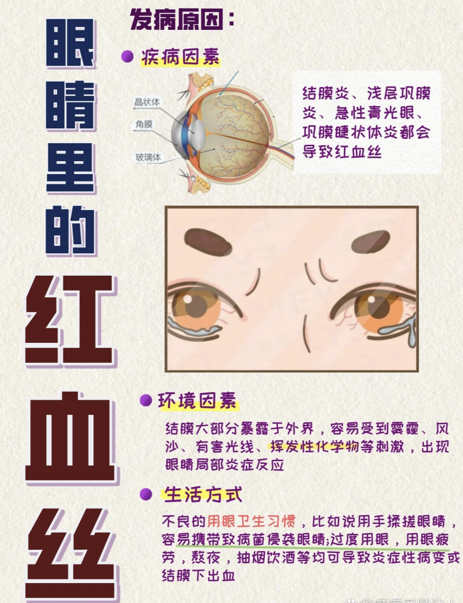 宝宝眼睛有红血丝是什么原因