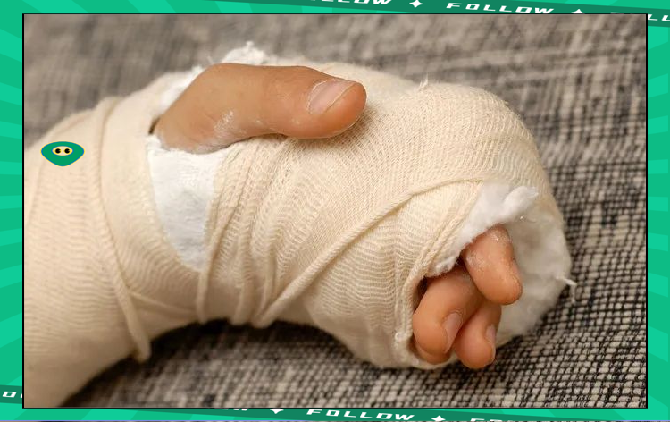 割腕要准备什么.怎么准确死亡