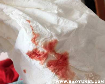 药物流产后恶露一般几天就没了