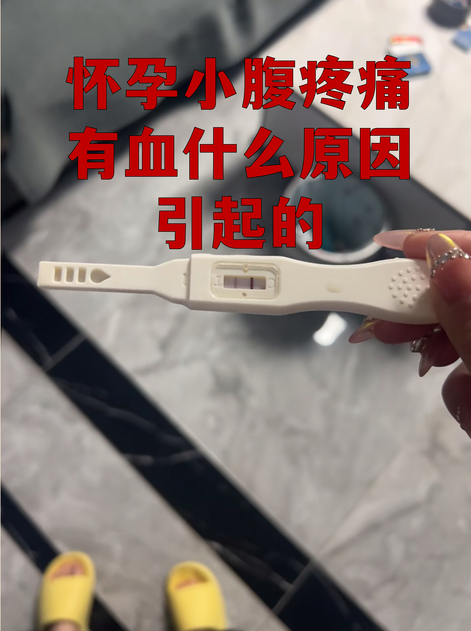 怀孕初期流产的征兆