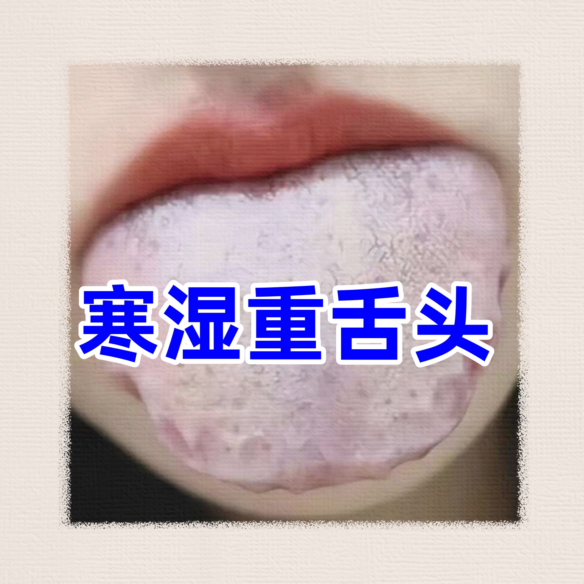 舌苔发白是怎么回事