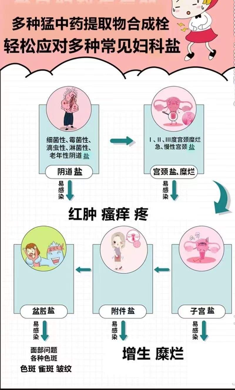 下面瘙痒怎么办