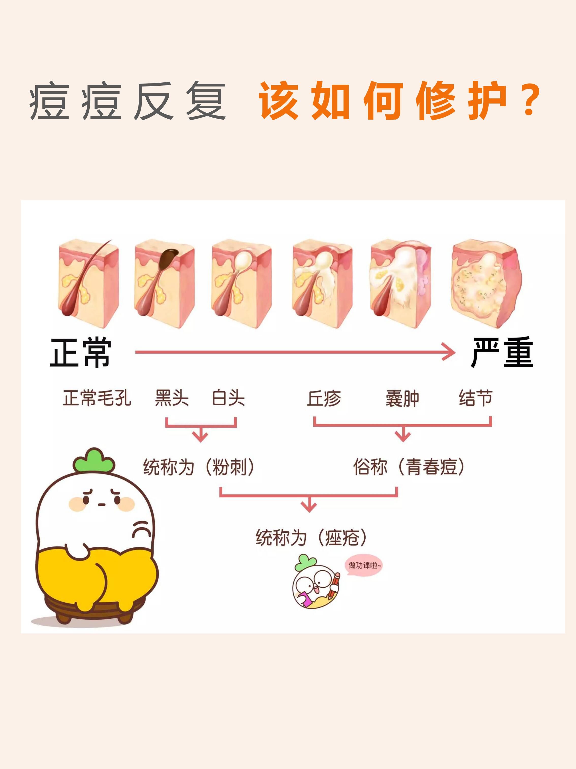 右脸颊长痘的原因