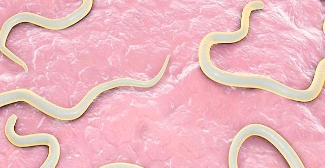 孕妇感染弓形虫的机率