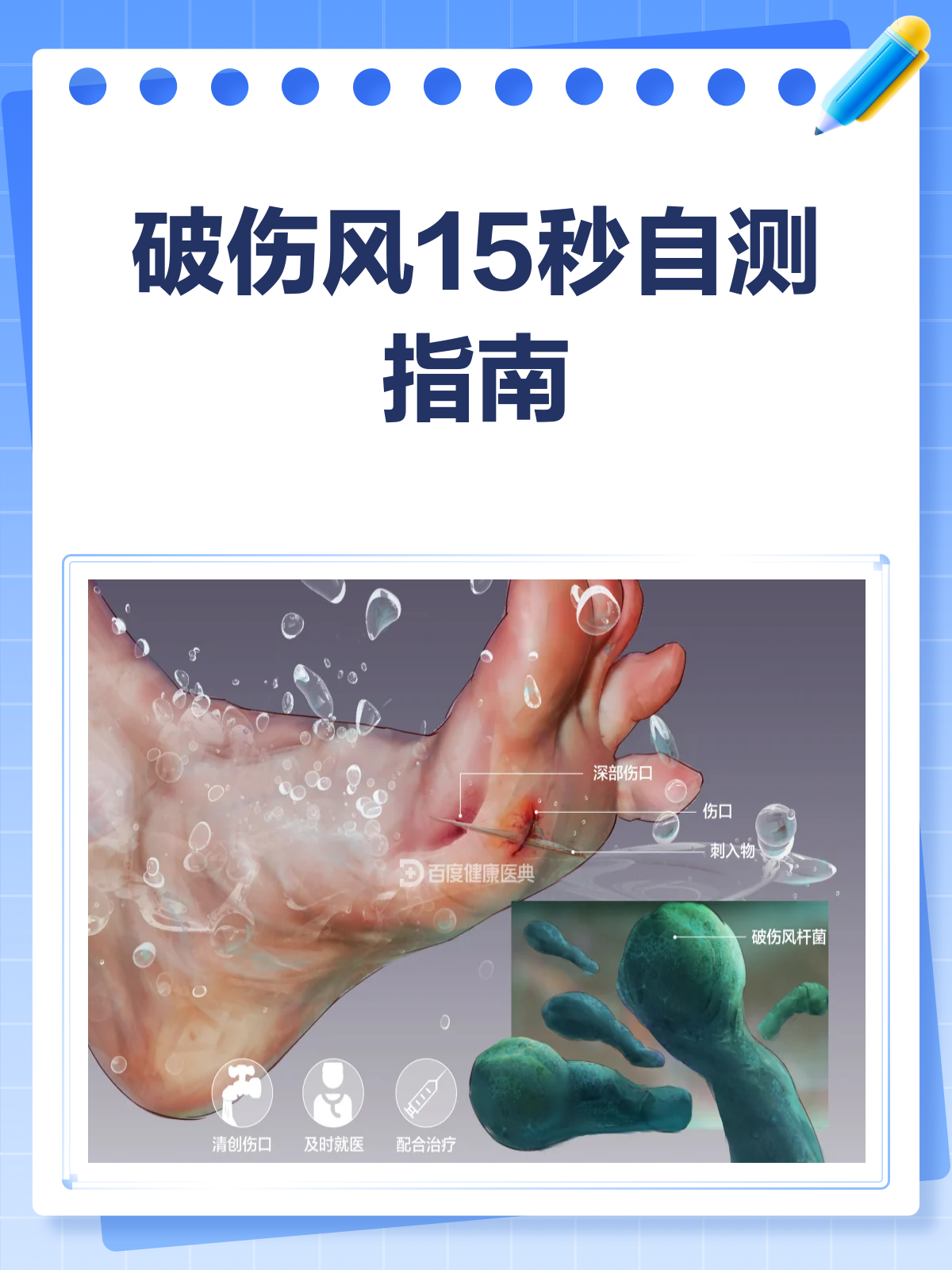 什么情况下要打破伤风