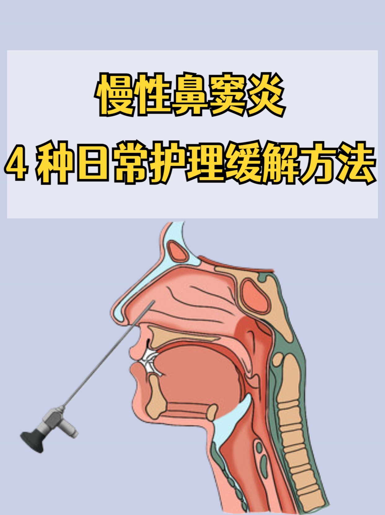 鼻窦炎可以治愈吗