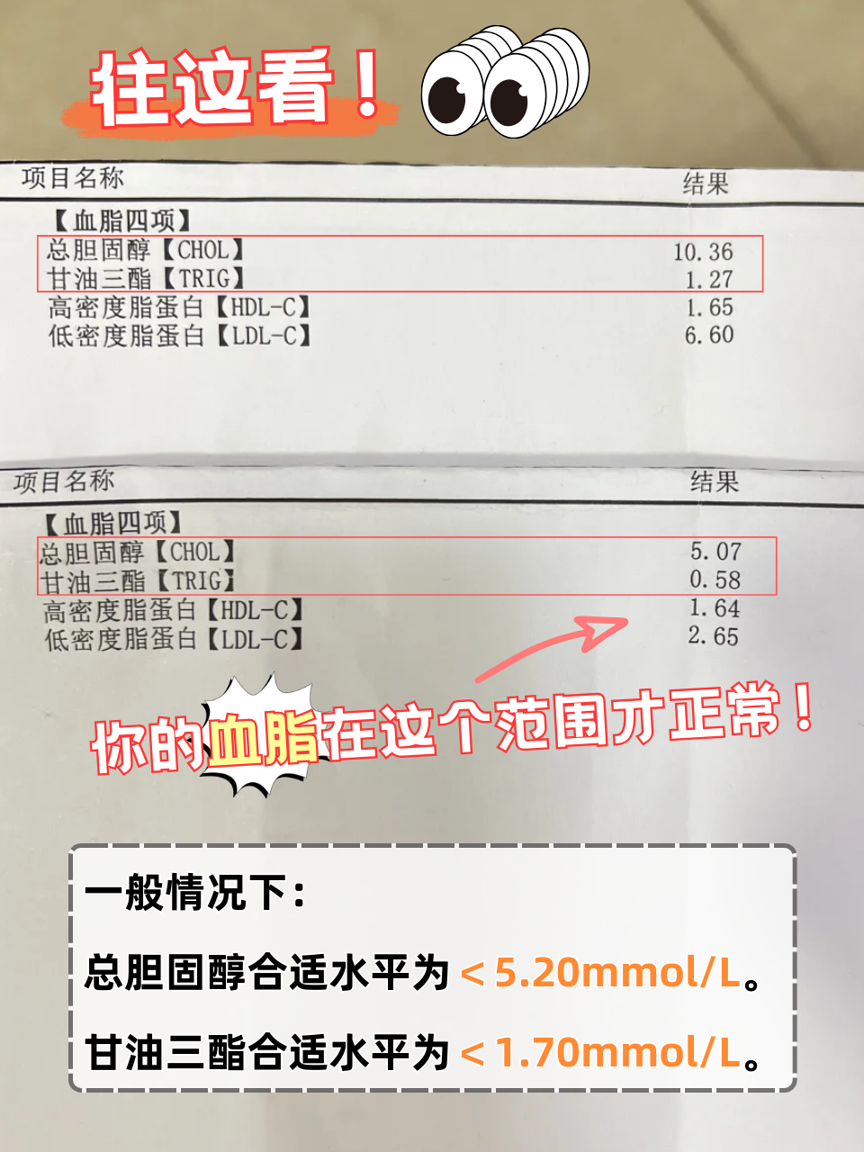 高脂血症诊断标准是什么?