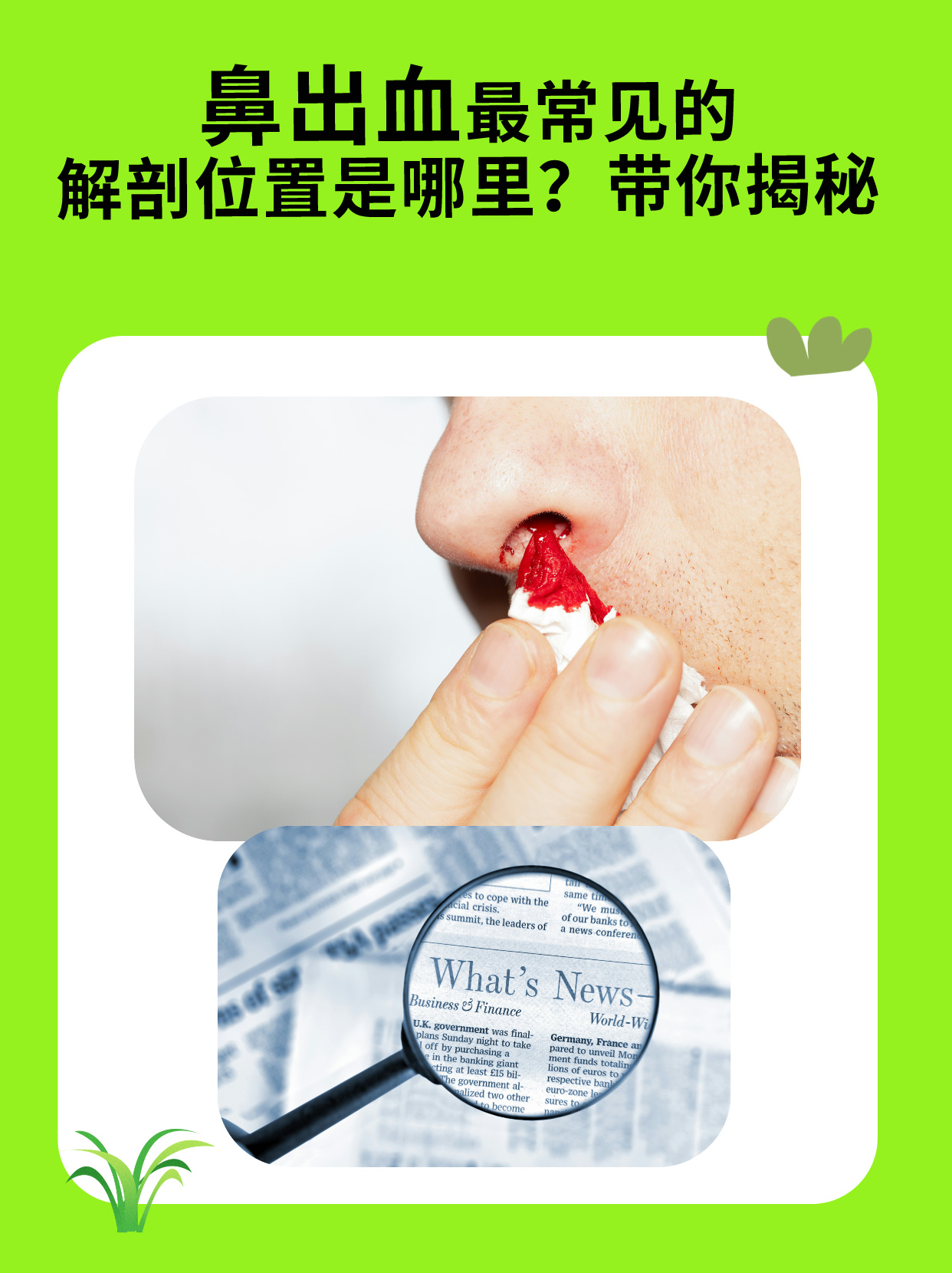 鼻腔异物如何取出