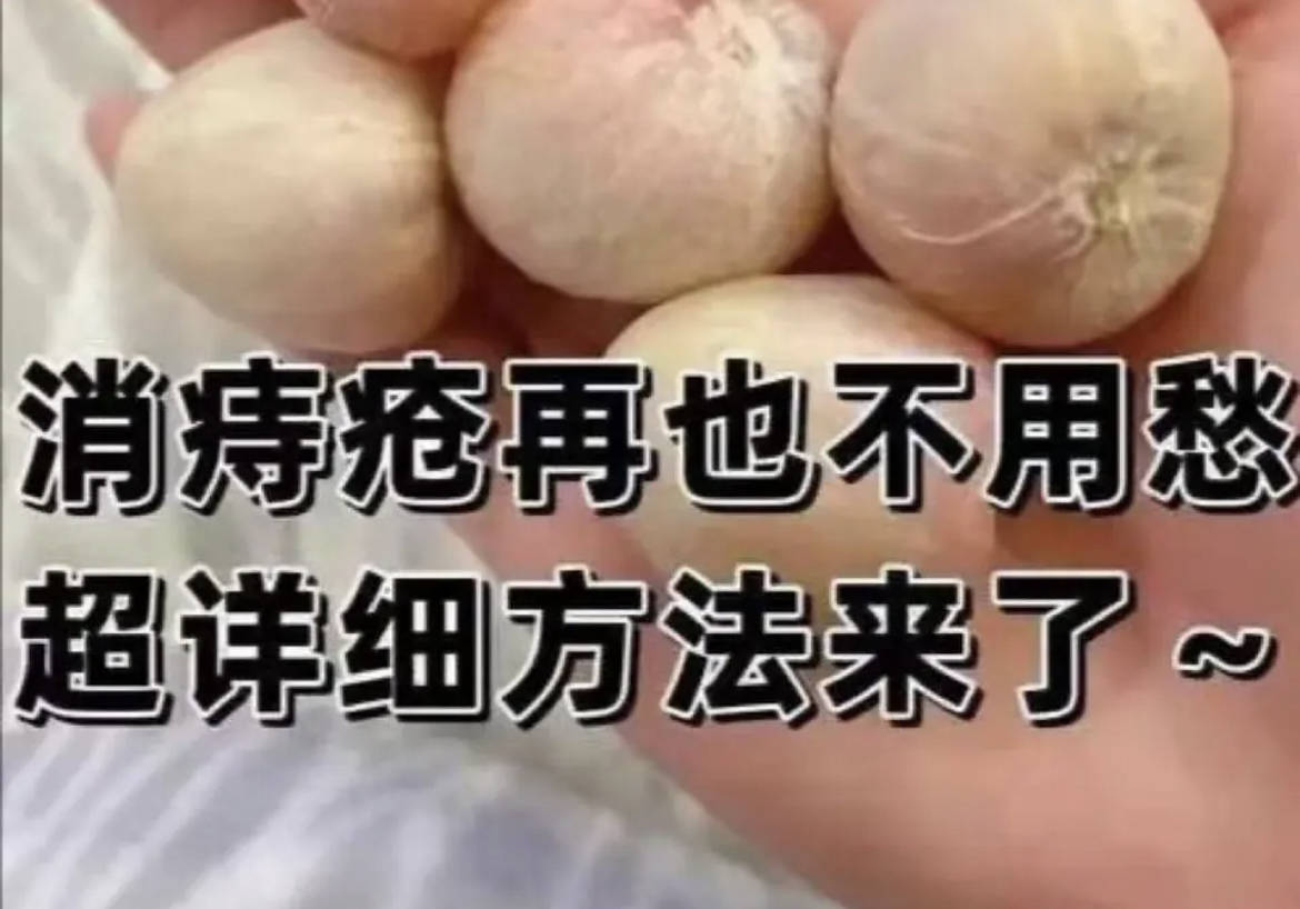 痔疮可以根治吗