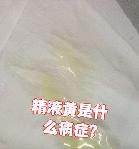 正常精子是什么颜色?