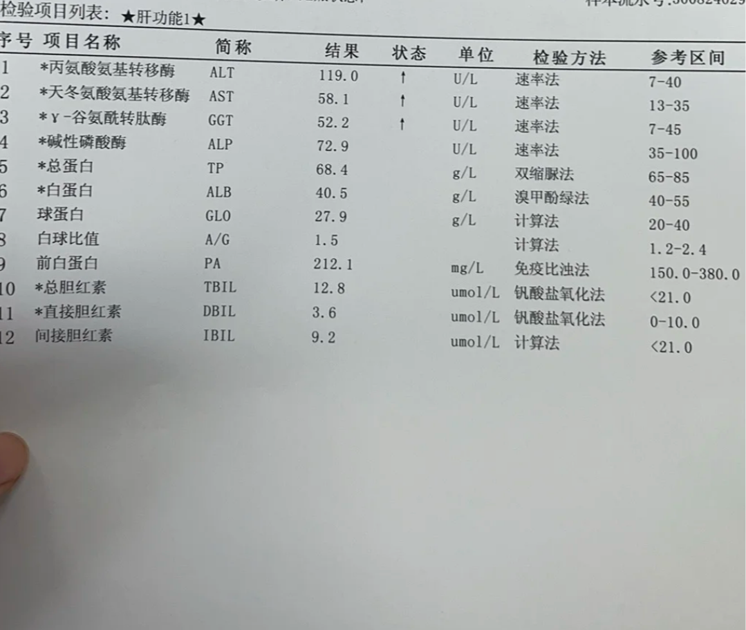 肝功能异常影响入职吗