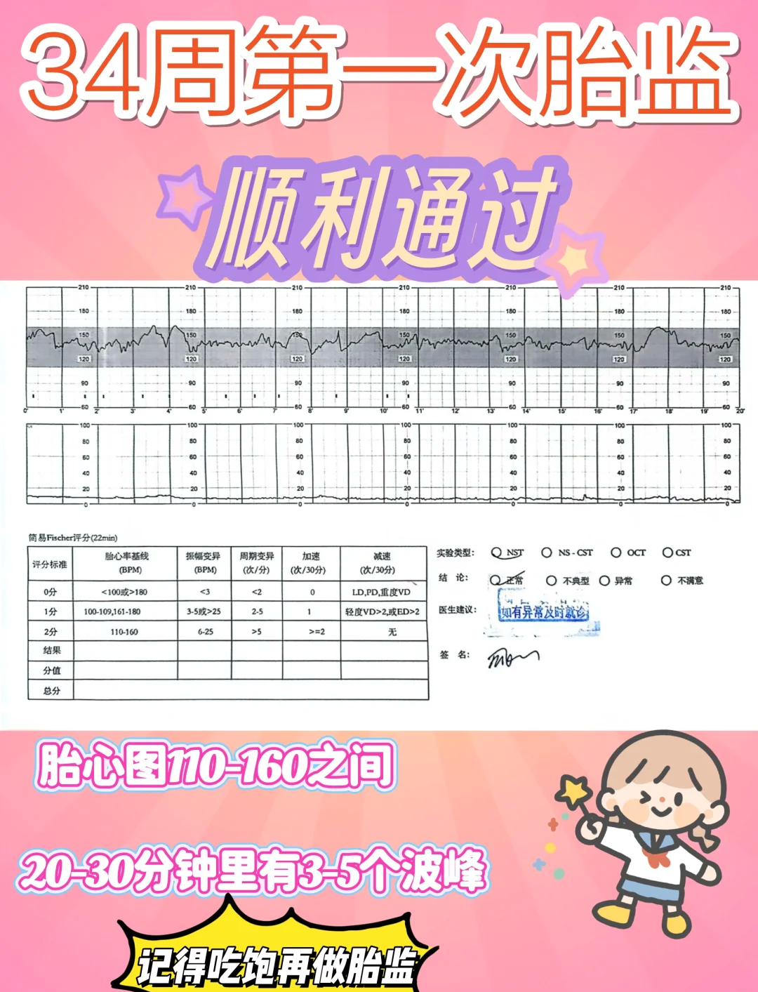 胎心监护怎么看宫缩