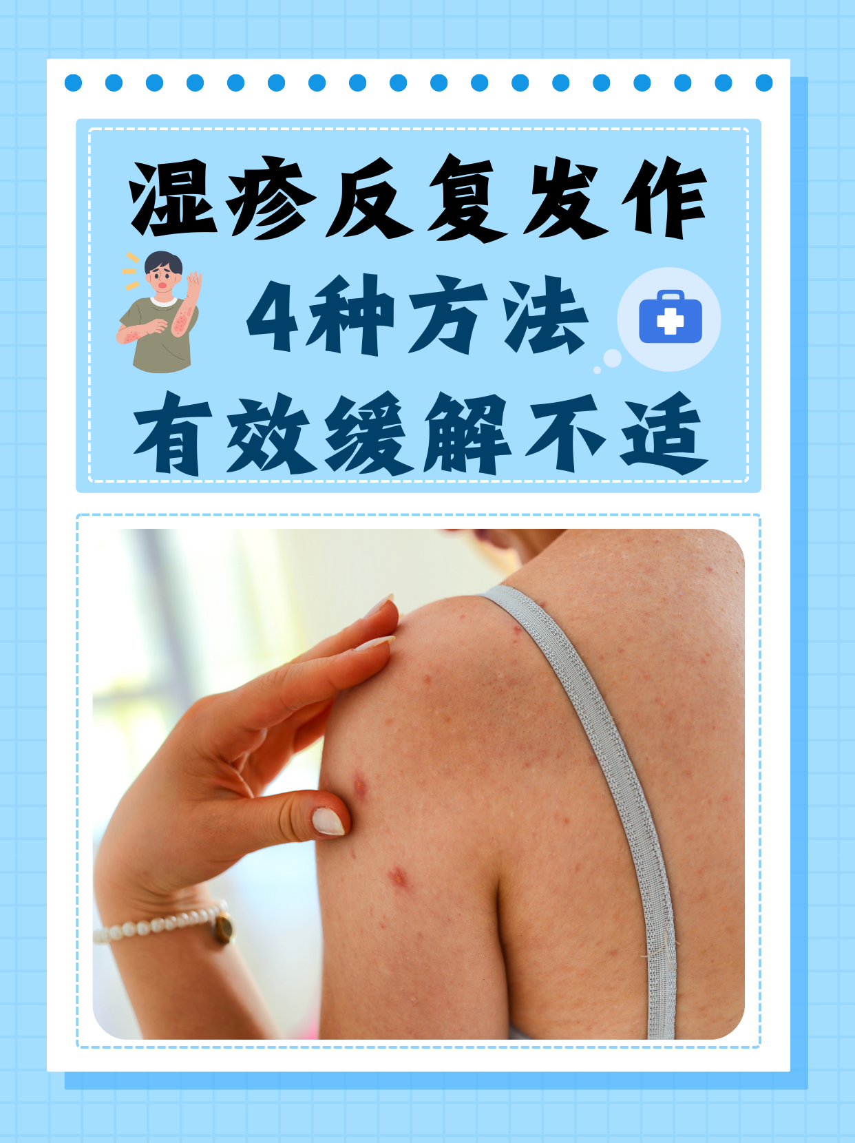 湿疹的治疗方法有哪些?