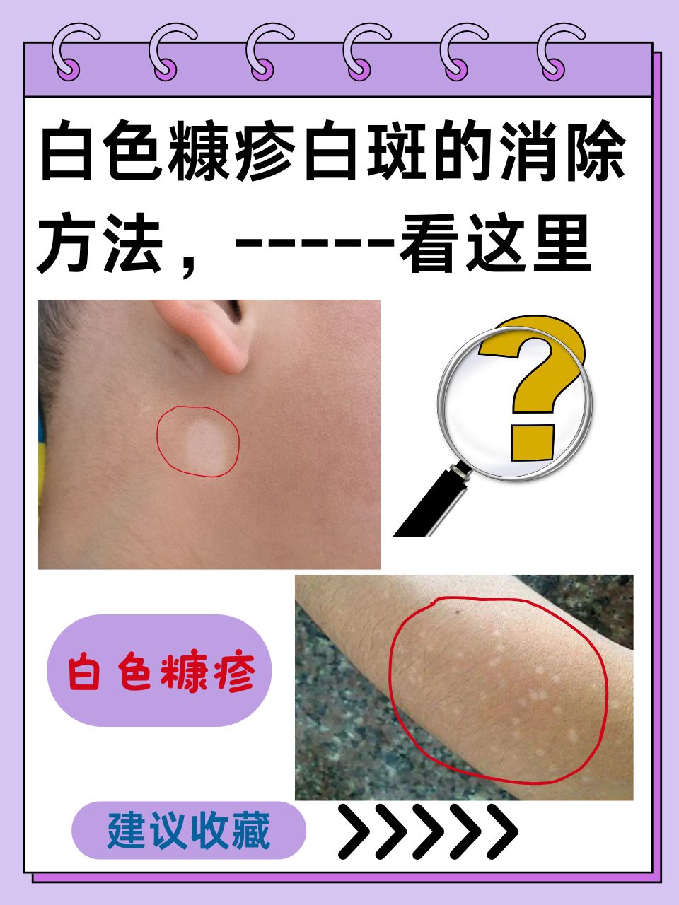 脸上起皮和白色碎屑怎么办