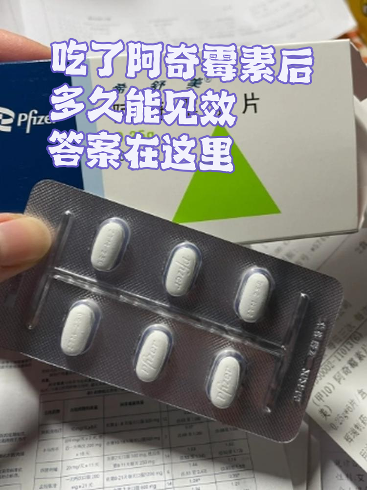 阿奇霉素可以消炎吗