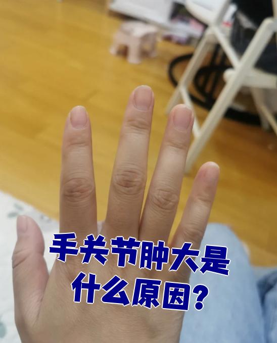 早上起来右手手指中间的关节肿大变形但不痛