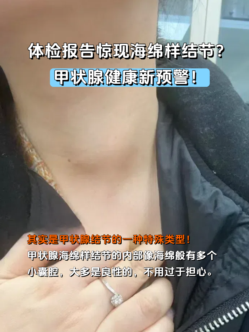 甲状腺结节是什么病